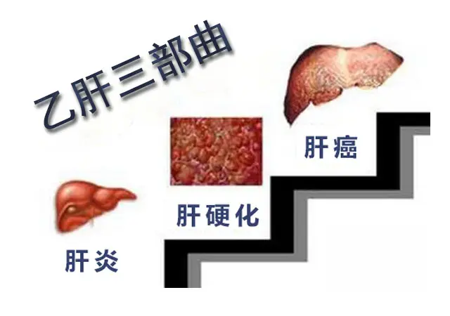 健康人感染乙肝的幾率是多少？